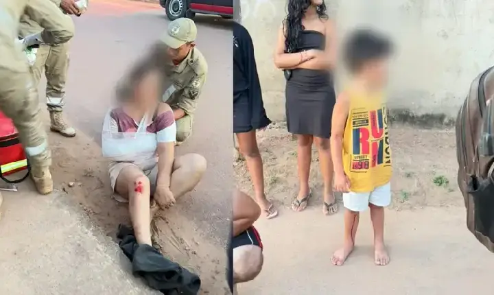 Motociclista fica ferida após atropelamento em Itaituba