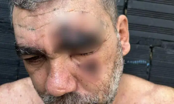 Motorista denuncia agressão por agentes da Semma em Marabá; caso é investigado pelo MP