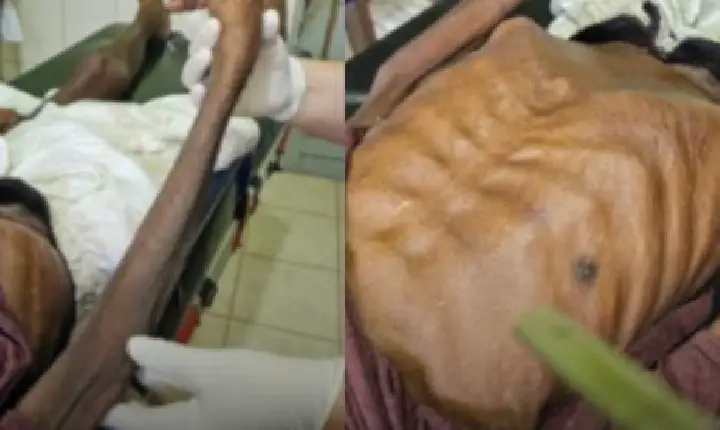 Mulher é presa suspeita de maus-tratos contra pai idoso que morreu em hospital em Ipixuna do Pará