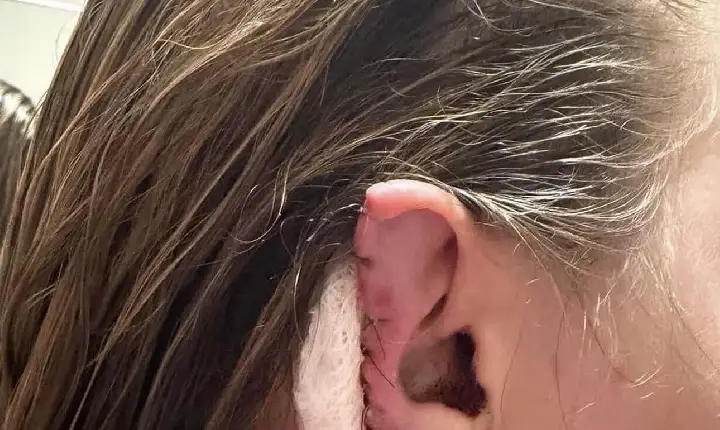 Mulher tem parte da orelha arrancada pelo ex-companheiro