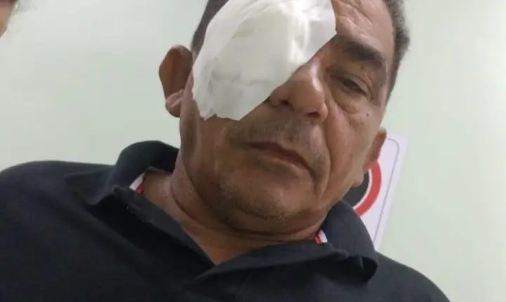 População de Itupiranga celebra sucesso do mutirão de cirurgias de pterígio da gestão Godoy