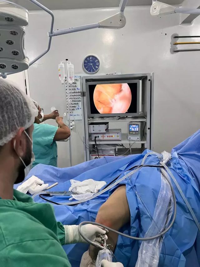 Primeira cirurgia ortopédica por vídeo é realizada na rede pública em Canaã dos Carajás