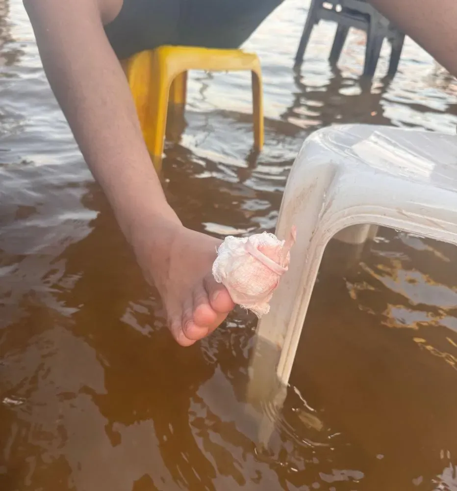 Perigo em CDA: turistas relatam ataques de piranhas
