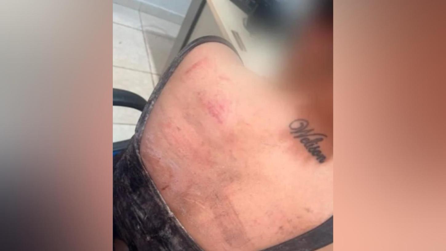 Mulher é agredida pelo ex-companheiro em Anapu