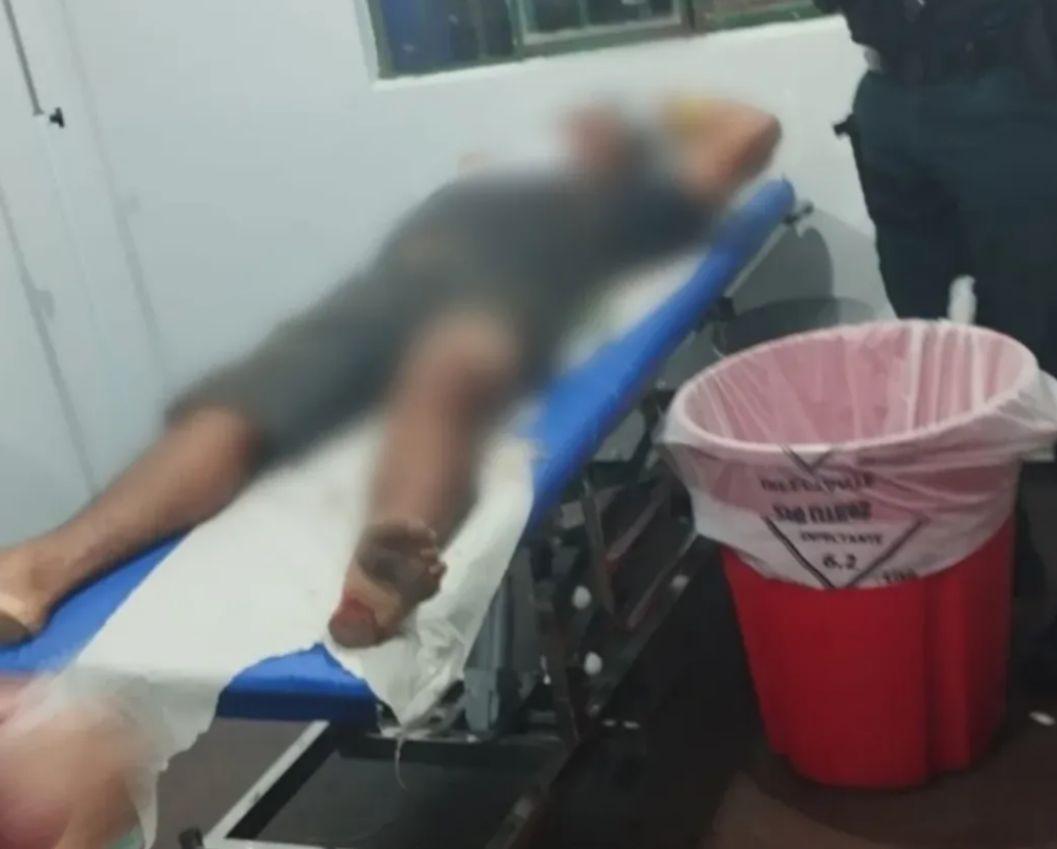 Eita! Homem é agredido em Parauapebas apor ser confundido com PM