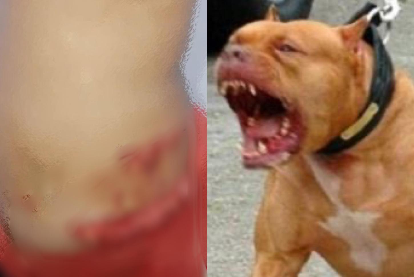 Criança é atacada por pitbull descontrolado em frente à casa da tia, em Parauapebas