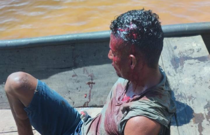 VÍDEO: Crime brutal choca Novo Repartimento: homem é preso suspeito de matar a própria mãe com foice