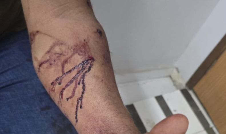 Mulher é presa após atacar marido e ferir bebê com tesoura em Parauapebas