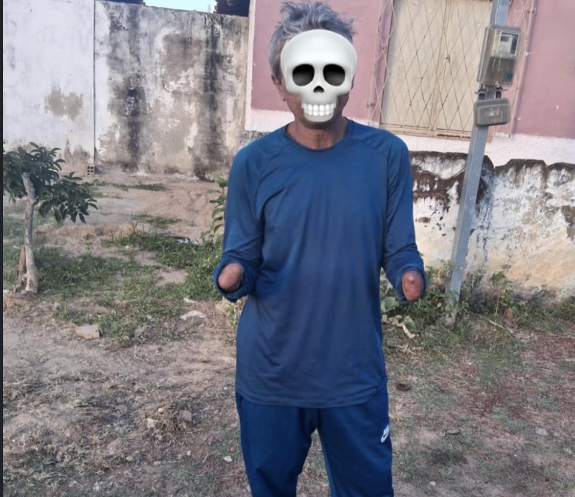 Homem que teve a mão decepada por roubo é flagrado furtando novamente