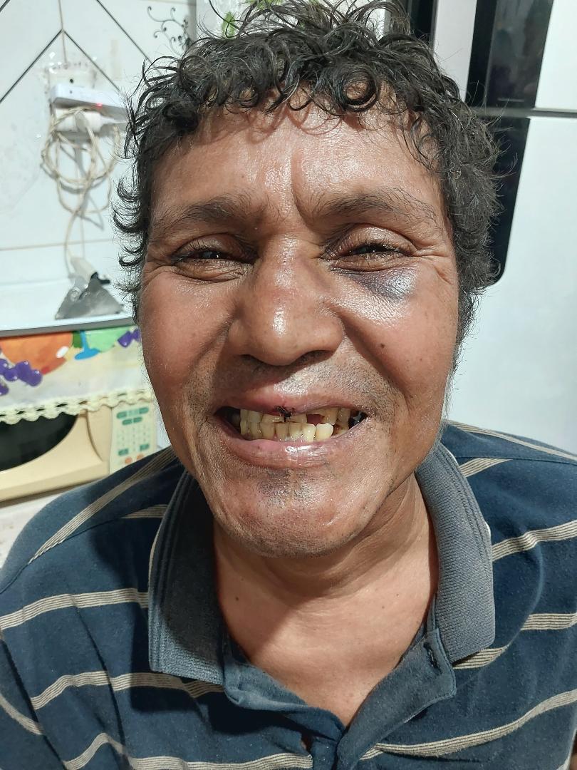 Homem de Canaã vai a Marabá para fazer perícia, espera horas na fila, passa mal e vira mendigo