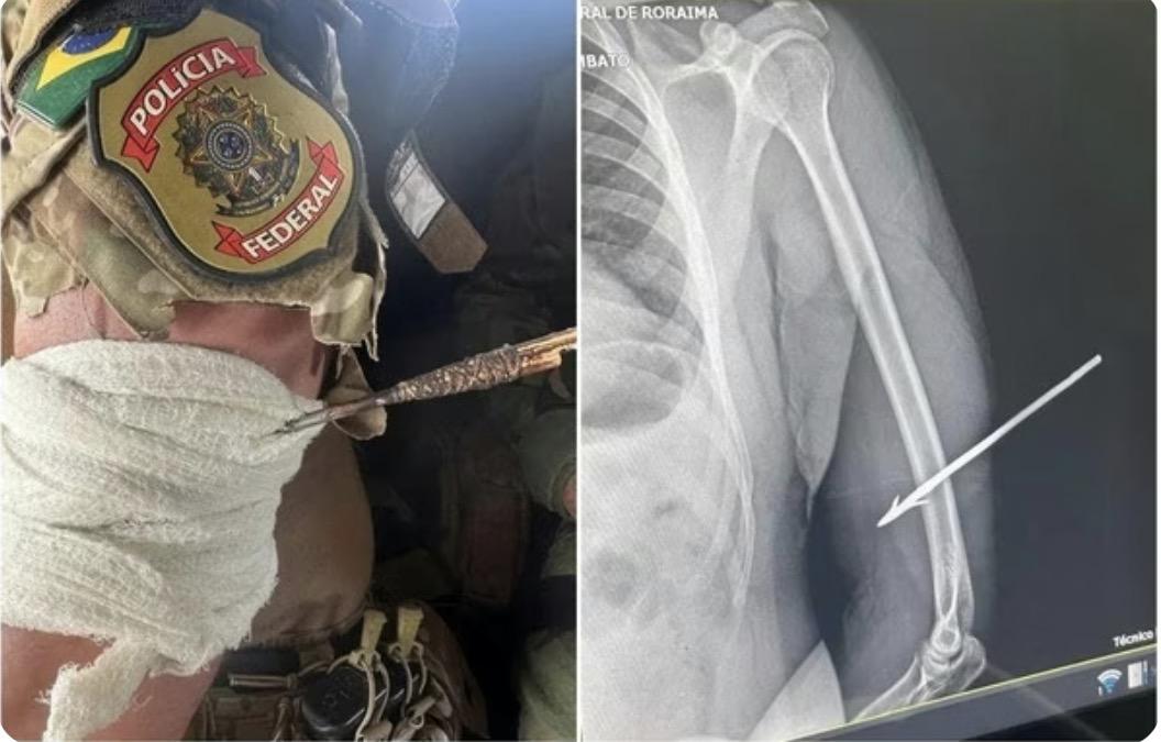 Policial federal é atingido por flecha durante operação contra garimpo ilegal em terra indígena de Roraima