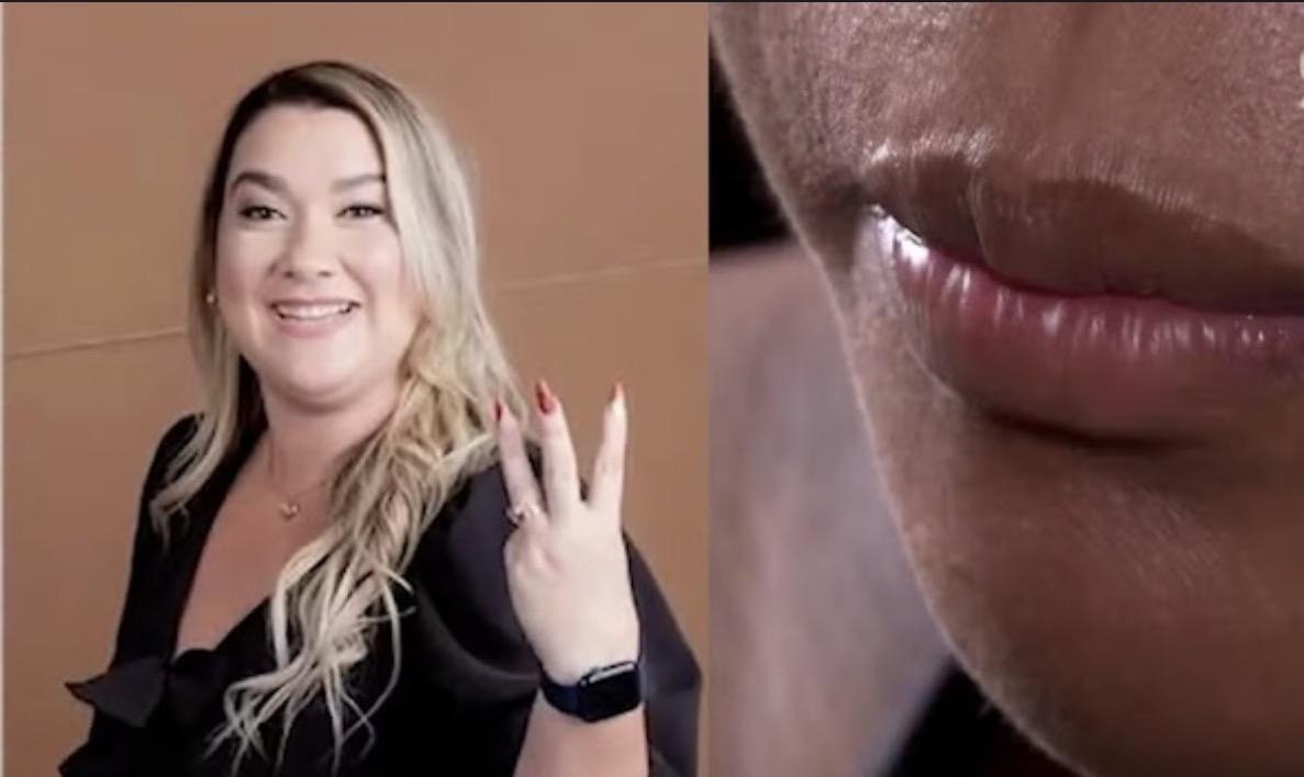 Grávida de 5 meses é agredida por ex-patroa no Maranhão e relata que tentou proteger o bebê durante ataques