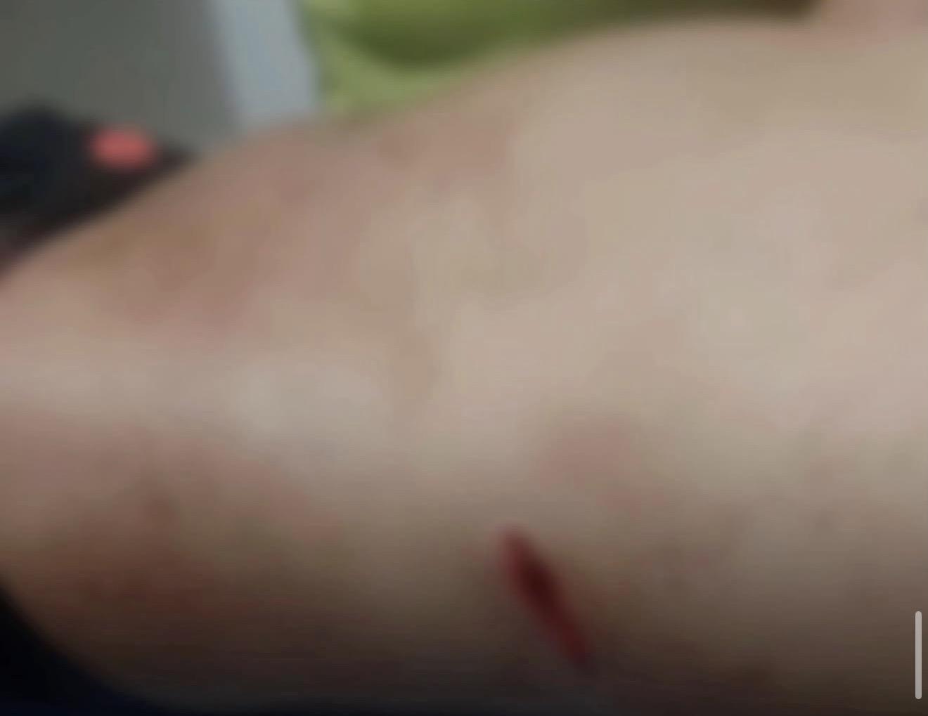 Homem é esfaqueado durante confusão em Curionópolis