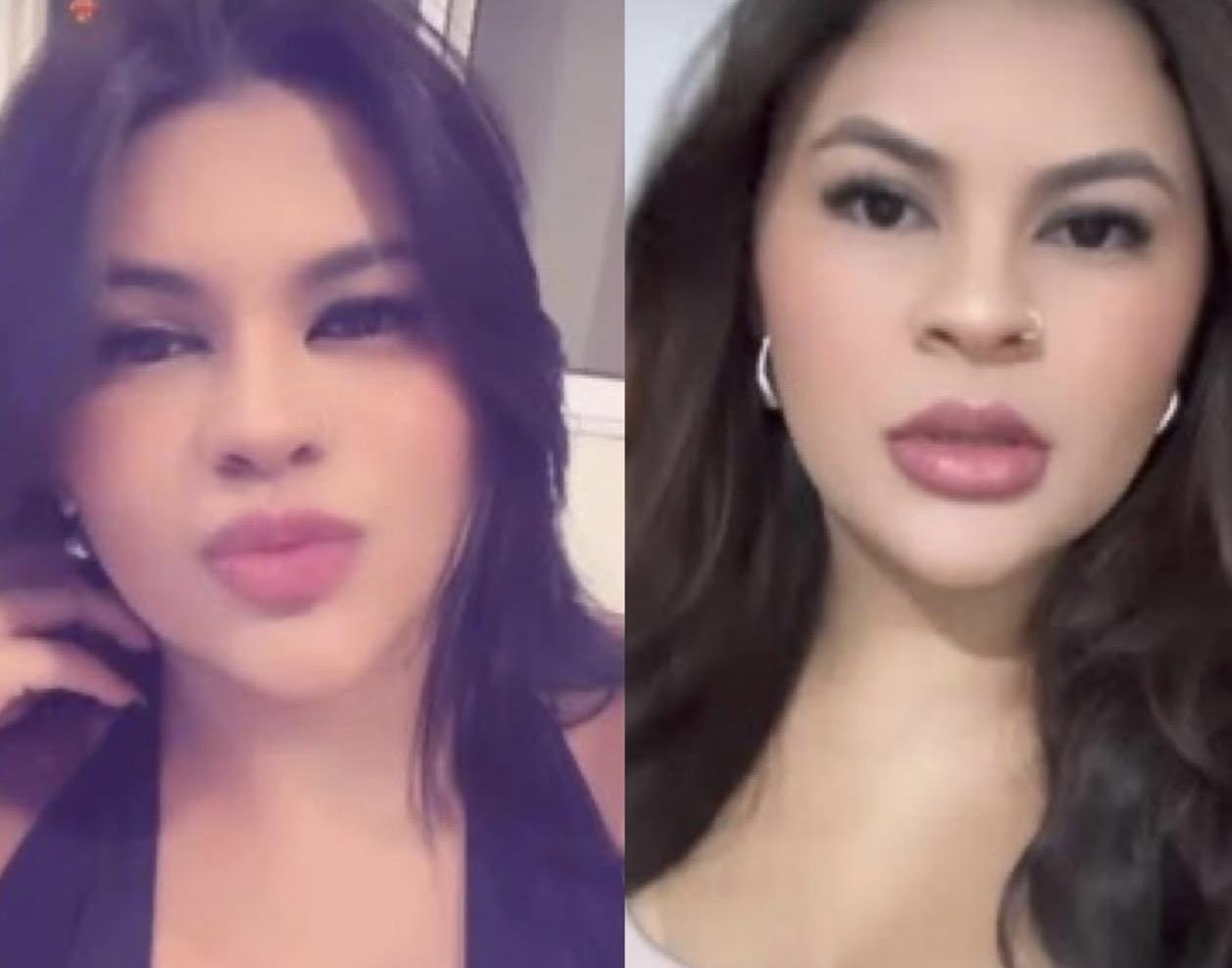 Jovem tem mãos reimplantadas após tentativa de feminicídio e apresenta primeiros movimentos