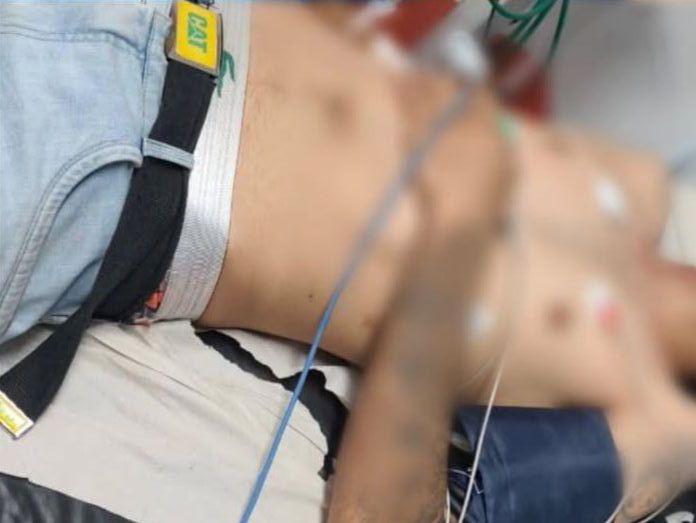 Parauapebas: dupla é baleada durante ataque a tiros em bar no Nova Carajás