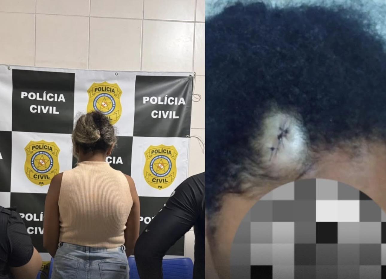 Mãe é presa suspeita de agredir filha de 13 anos com pedaço de madeira em São Miguel do Guamá