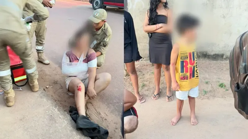 Motociclista fica ferida após atropelamento em Itaituba