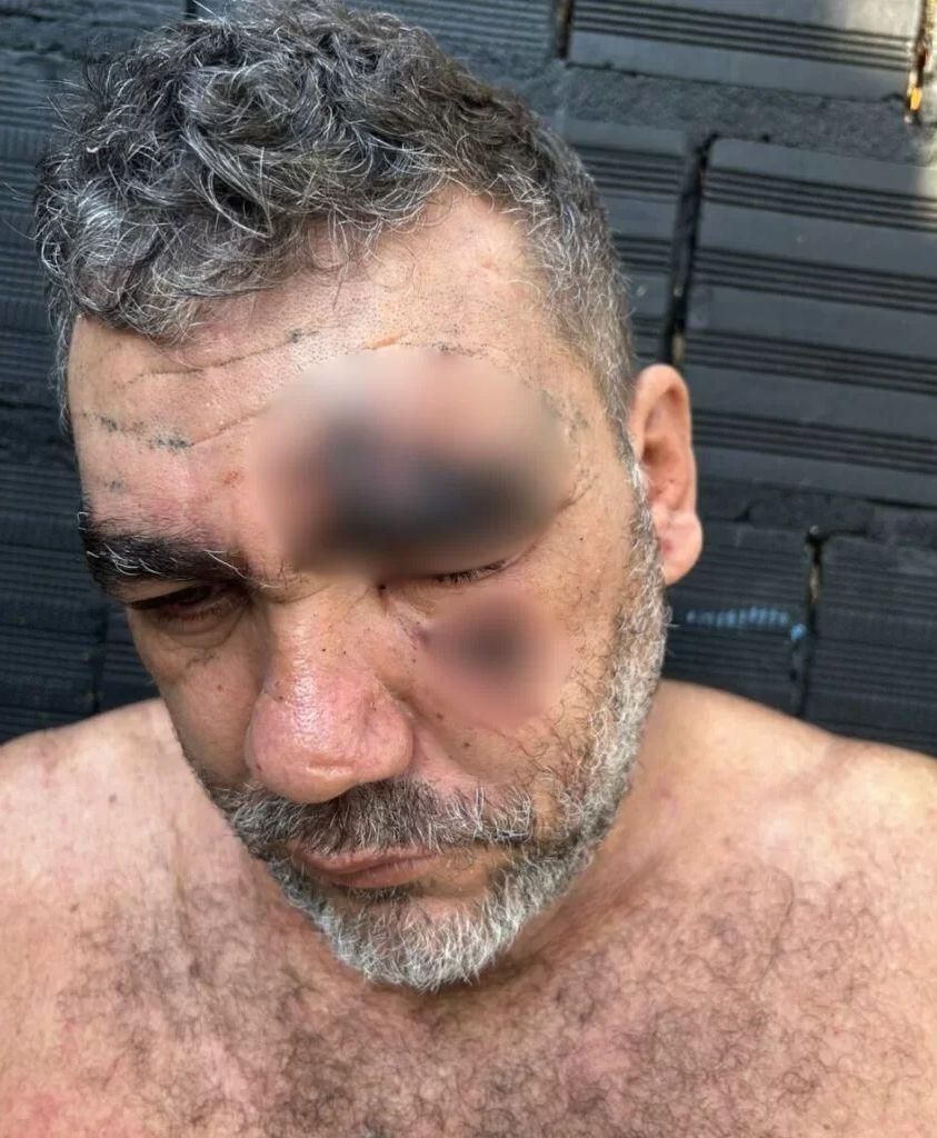 Motorista denuncia agressão por agentes da Semma em Marabá; caso é investigado pelo MP