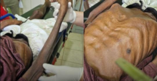 Mulher é presa suspeita de maus-tratos contra pai idoso que morreu em hospital em Ipixuna do Pará
