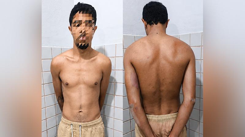 Grávida de 8 meses é agredida pelo companheiro em Jacundá