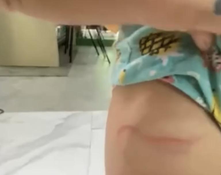 Mãe denuncia supostas agressões contra filha de 4 anos em Parauapebas 
