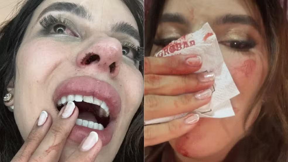 Balsas: polícia descarta transfobia em agressão contra influenciadora