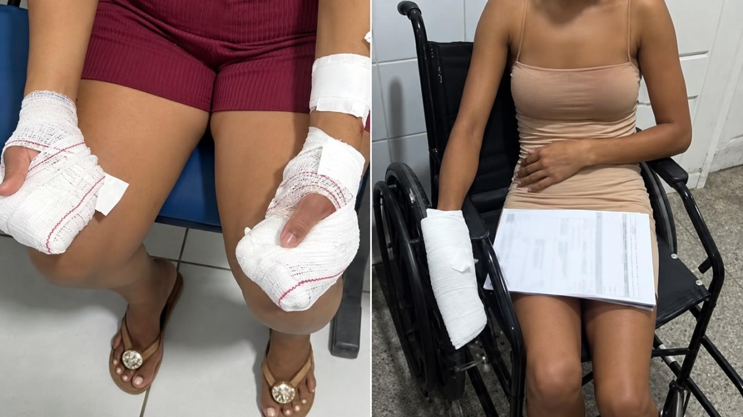 Homem é preso suspeito de atacar mãe com facão e namorada com faca em Codó