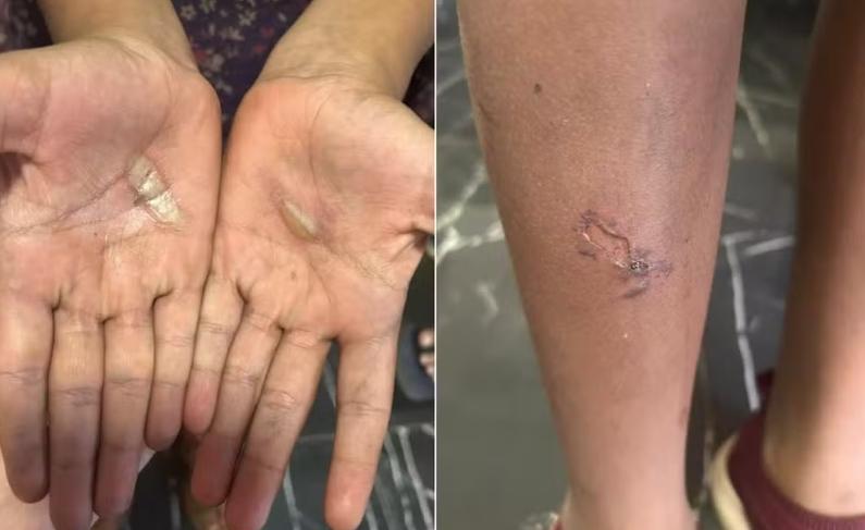 Pai é preso suspeito de queimar filhas após quebra acidental de caixa de som