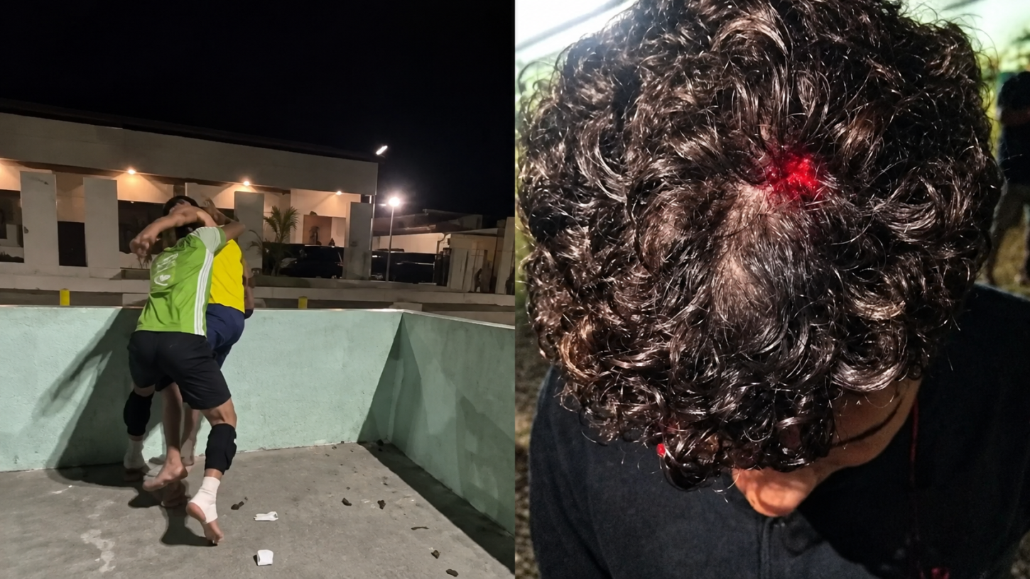 Policial civil é acusado de agredir dois adolescentes em praça pública em Moju