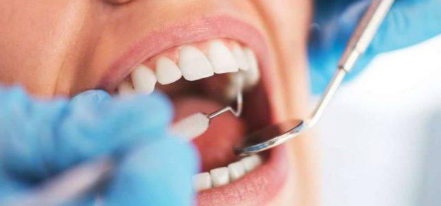UBS de Cumaru realiza triagem odontológica nesta quinta-feira (29)
