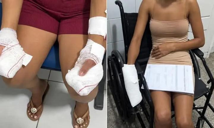 Homem é preso suspeito de atacar mãe com facão e namorada com faca em Codó