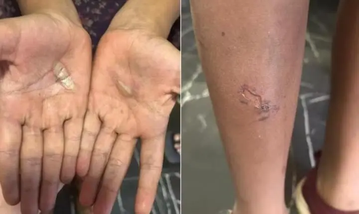 Pai é preso suspeito de queimar filhas após quebra acidental de caixa de som
