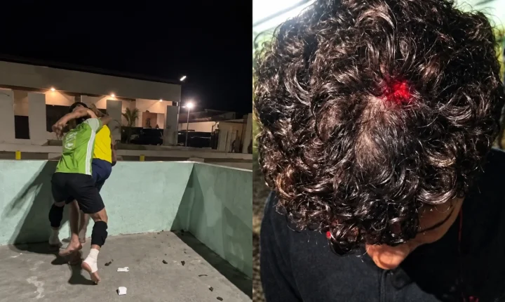 Policial civil é acusado de agredir dois adolescentes em praça pública em Moju