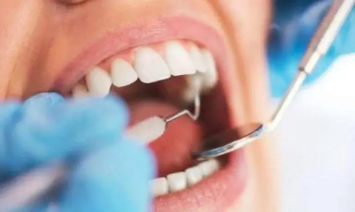 UBS de Cumaru realiza triagem odontológica nesta quinta-feira (29)
